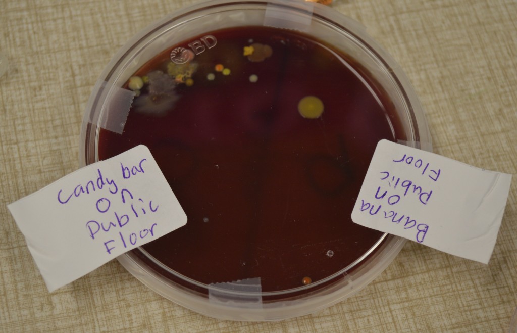 THESE ARE THOSE results - the bacteria that grew on an unwrapped candy bar dropped for five seconds on a public floor, at the left, and a peeled banana plopped on a public floor for five seconds, at the right. Deeelicious!